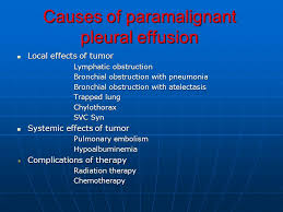 More than one half of these massive pleural effusions are caused by malignancy; Shahid Beheshti University Ppt Download