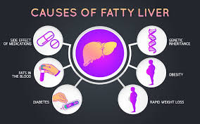 The keto diet is primarily used to help reduce the frequency of epileptic seizures in children. 6 Tips To Reduce Fatty Liver Disease Common Complication Of Diabetes Obesity Developing Non Alcoholic Fatty Liver Disease Or Nafld Occurs In People With Obesity And Type 2 Diabetes And Can Be Reversed