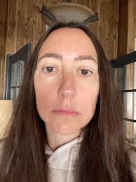 Considering a facelift, looking for suggestions and advice :  r/PlasticSurgery