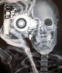 X Ray Photography Imgur X Ray Images X Ray Photographer