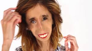 6 or more scouts a blanket or jacket to cover one actor's head one scout is the ugliest man and is under a blanket. The Ugliest Woman In The World Shares What Makes Her Feel Beautiful Video Allure