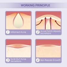 Acne Face Wash Liberex Acne Pimple Master Patch 60 Dots Hydrocolloid Absorbing Dressing Bandages Cover Aza 12mm Overnight Acne Remedies Acne Face Wash Acne