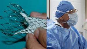 Porque en el fondo siente placer de su trabajo. Las Nuevas Valvulas Cardiacas Que Se Implantan Sin Operar A Corazon Abierto Fundacion Favaloro