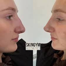 Alex Jackson (@skingymaesthetics) • Instagram photos and videos