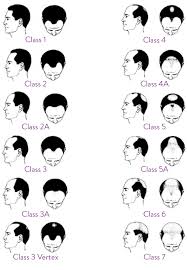 Consult your doctor for treatment options that are best suited to your needs. Stages Of Hair Loss Hair Transplantation Toronto