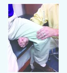 Image result for Fulcrum Test