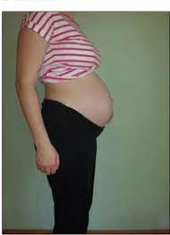 Zwillingsbauch Forum Zwillinge Mehrlinge Urbia De