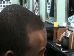 How to treat a receding hairline. How To Fix A Lightly Receding Hairline Without Dyes Youtube