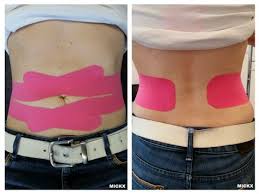 Tape Diastasis Recti Umbilical Hernia Diastase Tape Navelbreuk Always In Combination With Excer Diastasis Recti Exercises Diastasis Recti Postnatal Workout