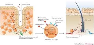 Varicella is a common childhood illness, characterized by fever, viremia, and scattered vesicular lesions of the skin. Molecular Mechanisms Of Varicella Zoster Virus Pathogenesis Nature Reviews Microbiology