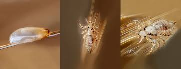 Image result for lice life cycle
