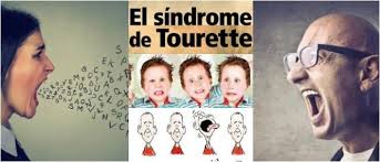 Sindrome De Tourette Clasificacion Caracteristicas Fisiopatologia Diagnostico Tratamiento Y Pronostico Arriba Salud