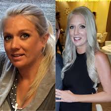 Raven lost 61 pounds after giving birth to her son.  www.blackweightlosssuccess.com/raven-lost-61-pounds/ PCOS, endometriosis,  and postpartum diastasis recti could not stop this RN and future Midwife  from striving to be the best version