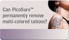 It's important that our customers are educated about the tattoo removal process in order to provide a positive experience. Laser Tattoo Removal Dermatology Associates Of Atlanta Ga
