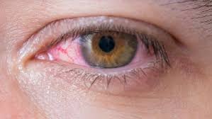 Hantavirus has attracted more and more attention as an emerging pathogenic virus in the past decades. Hantavirus Symptome Ursachen Und Schutz Vor Dem Gefahrlichen Erreger