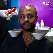 💫Embrace Your Beautiful Roots with Afro Hair Transplant! 👍We understand  that importance of your hair and self confidence! 👉For those who've  experienced hair loss, we're here to help you regain your confidence