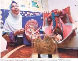 Rafidah abdullah mengenai punca penyakit buah. Kian Ramai Rosak Buah Pinggang Hospital Pengajar Universiti Putra Malaysia