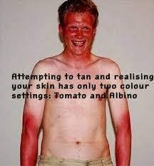 Sunburn Fails Worst Sunburns Badly Burnt Skin Pictures Bad Sunburn Tan Sunburn Meme