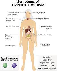 Malayalam health tips about thyroid diseas and types of thyroid surgery. Daily Health Malayalam à´¯ à´± à´• à´• à´¸ à´¡ à´Žà´¨ à´¨ à´® à´°à´• à´µ à´² à´²àµ» Hyperthyroidism Enlarged Thyroid Thyroid Symptoms