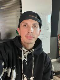 new song is dropping in like 4 hours, the road to this one was crazy. In my  last 11 days I- Got cancer cut out of my face (I'm cancer free now