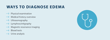 Image result for Edema Exam