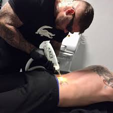 Pens & needles custom tattoo company. Serious Ink Laser Tattoo Removal Falmouth Tattoo Removal Yell