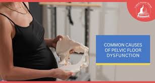 Image result for Pelvic Floor Dysfunction