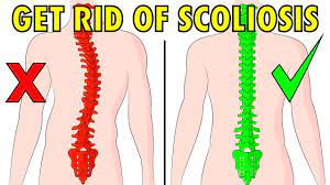 Balance helps restore good physical functioning. How To Fix Scoliosis Naturally In 4 Minutes A Day Youtube