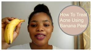 How To Get Rid Of Acne In One Minute How To Treat Acne Using Banana Peels Youtube There are many types of peels but they ar. how to get rid of acne in one minute how to treat acne using banana peels