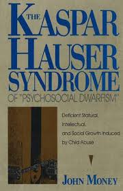 He was planted as an infant on earth at nuremberg in 1828. Kaspar Hauser Syndrom Lexikon Der Neurowissenschaft