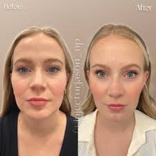 Jason Tye DNP, FNP-c