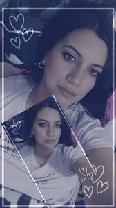 Me quitan los puntos en dos días, ¡qué emoción!