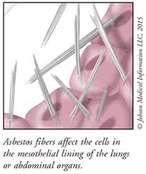 This cancer develops in the layer of tissue that covers many internal organs in the body. Mesothelioma