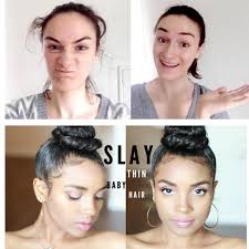 As these symptoms may only become visible under a magnifying lens or trichoscope, it can be hard to tell without a professional's input which is the cause. Buy Hair Edge Control Gel Stick Slay Thin Baby Hair Perfect Hair Line Styling Smooth Frizziy Hairs Non Greasy 75g At Affordable Prices Free Shipping Real Reviews With Photos Joom