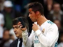 C'est plus facile de trouver de bonnes entreprises grâce aux recommandations. Video Cristiano Ronaldo Le Visage En Sang La Star Demande Un Telephone En Plein Match Pour Constater Les Degats