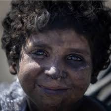 Tragedy in Gaza, life cut short