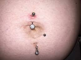 Sale Infected Belly Button Piercing While Pregnant Is Stock
