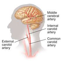 The right and left common carotid arteries run up the neck on the respective side in the carotid sheath along with the internal jugular vein and vagus nerve. Carotid Artery Disease Vascular Cures