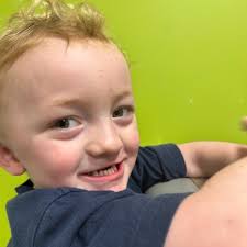 UMMC Pediatric Plastic Surgery