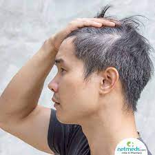 Grey Hair In Teens? Here's What You Can Do