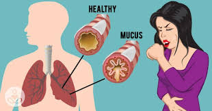 How To Get Rid Of Mucus And Phlegm In Your Chest And Throat As Fast As Possible Getting Rid Of Mucus Chest Congestion Remedies Getting Rid Of Phlegm
