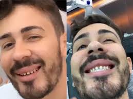 Carlinhos maia choca ao mostrar dentes naturais durante manutenção de lentes. Carlinhos Maia Choca A Web Ao Mostrar Dentes Sem Lente De Contato Veja Tribuna Top