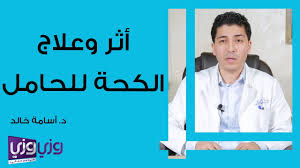علاج الكحة للحامل في الشهور الأولى سطور