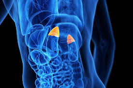 Cancerul pulmonar provoacă mai multe decese decât cancerul de sân, de colon și de prostată la un loc. Cancerul Pulmonar Se RÄspandeÈte La Glandele Suprarenale
