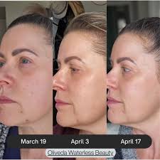 Skincare Sunday ☀️