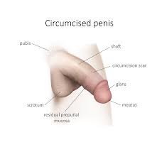 Circumcision | Adult Circumcision Clinics in Montreal and Quebec