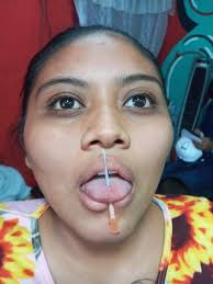 Acción Médico Poética #AMP...