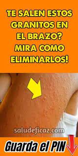 Como Eliminar Los Granitos De Los Brazos Homemade Bath Bombs Recipe Health Tips