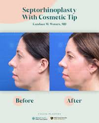 Wake Forest Baptist Facial Plastic & Reconstructive Surgery added a new  photo — at Wake Forest Baptist Facial Plastic & Reconstructive...
