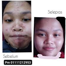 Forever Living Hulu Langat